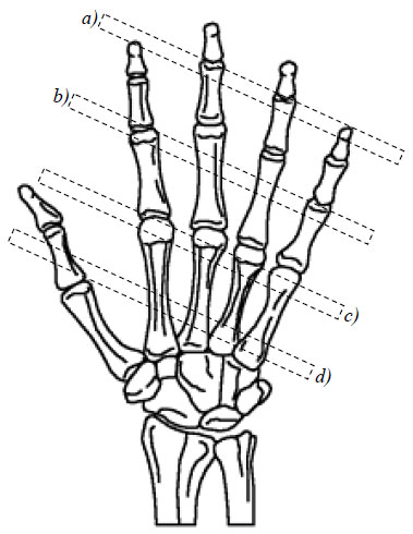 figure 22