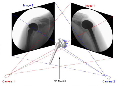 Figure 14 Virtual DFIS recreated in computer space from the geometry of the actual fluoroscopic system, shown with CAD models of total shoulder arthroplasty.