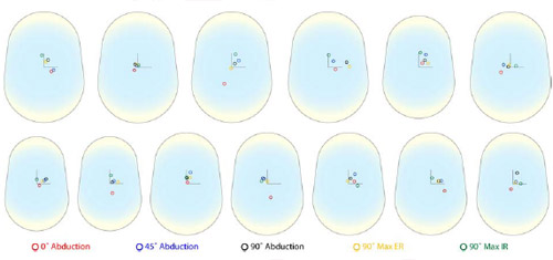 Figure 24 Unscaled patient humeral head center locations on the glenoid surface as a function of arm position, shown by color code. All right shoulder humeral head centers locations were mirrored to left glenoid components.