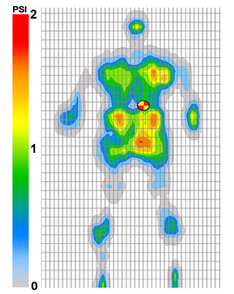 surface pressure