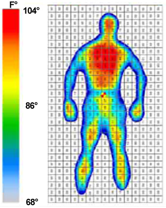 surface temperature