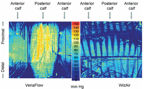 pressure mapping results