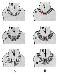 Abb. 2.19: Belastungsschema fr das kongruente Gelenk (A) und das physiologisch inkongruente Gelenk (B) unter geringer Belastung F1, und steigender Belastung F2, F3; die Verteilung des Drucks im physiologisch inkongruenten Gelenk ist gleichmiger und ohne lokale Druckspitzen im Gegensatz zum kongruenten Gelenk (Abb. nach Eckstein et al., 1993).