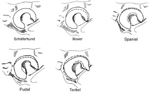 Abb. 2.3: Formen des Acetabulum, Lateralansicht des linken Acetabulum; die gestrichelte Linie gibt die Kontur der Facies lunata des Schferhundes wieder (Abb. nach Richter, 1977).