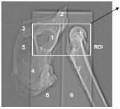 Abb. 3.5: Topogramm, Hemipelvis links, Os femoris rechts, unterlagert vom Phantom. 1 Facies lunata, 2 Os ilium, 3 Os pubis, 4 Os ischii, 5 For. obturatum, 6 Caput ossis femoris, 7 Femurschaft, 8 Phantom, Wasserquivalent, 9 Phantom, Spongiosaquivalent, ROI = Region of interest.