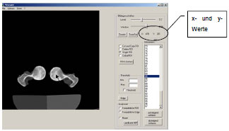 Abb. 3.9: Ablesen der x- und y- Koordinaten im Programm MEASURE.