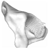 Abb. 4.14: Schematische Darstellung der Spaltlinien des Gelenkknorpels an der Kaudalflche eines linken Acetabulum; die Spaltlinien ordnen sich am kaudoventralen Rand spiralfrmig an.