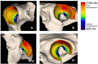 Abb. 4.19: Verteilungsmuster der subchondralen Knochendichte im Acetabulum eines ca. 6 Jahre alten, mnnlichen Dobermanns; A Kranialflche, B Dorsalflche, C Kaudalflche, D gesamte Gelenkflche im berblick.