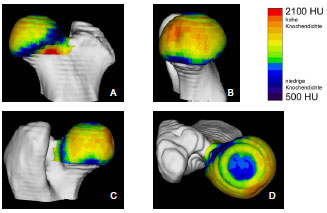 Abb. 4.21: Knochendichteverteilung am Femurkopf eines Zwergschnauzer-Mischlings, ca. 4 Jahre alt, weiblich; A Kranialflche, B Medialflche, C Kaudalflche, D Dorsalflche.