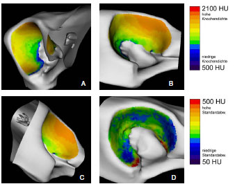 Abb. 4.23: Darstellung der mittleren Knochendichte (A-C) und der Standardabweichung (D) im Acetabulum; A Kranialflche, B Dorsalflche, C Kaudalflche des Acetabulum, D gesamte Gelenkflche.