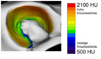 Abb. 4.26: Mittelwert der subchondralen Knochendichte im Acetabulum der Gruppe 'mnnlich' dargestellt an einer Referenzgelenkflche.