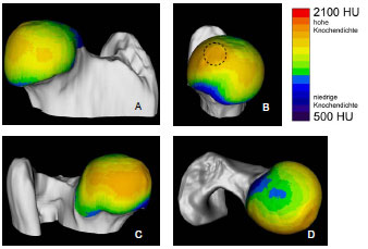 Abb. 4.28: Darstellung der mittleren Knochendichte am Caput ossis femoris, Kranialflche, B Medialflche; gestrichelter Kreis = Fovea capitis, C Kaudalflche, D Dorsalflche.