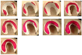 Abb. 4.39: Fotoserie Kontaktflchen, Ansicht eines linken Acetabulum von lateral, Bobtail-Mischling (w1 159), 24 kg, weiblich, 10 Jahre alt; 1-9 Belastungsstufen rel. zum Krpergewicht; 1) 25%, 2) 50%, 3) 75%, 4) 100%, 5) 150%, 6) 200%, 7) 250%, 8) 300% 9) 400% des Krpergewichts.