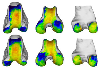 Abb. 32: Seitenvergleich der Knochendichteverteilung der Facies articularis femoris von linkem (oben) und rechtem (unten) Femur eines Mischlinghundes, mnnlich,21 kg, Altersgruppe III (Knie 28). Von links nach rechts: Ansicht von kranial, kraniodistal und kaudal.