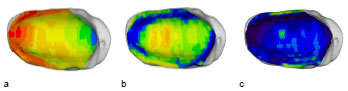 Abb. 46: Vergleichende Darstellung der auf das, Normgelenk projizierten individuellen Knochendichteverteilung der Facies articularis tibiae von drei verschiedenen Hunden. a: rechte Tibia eines Mischlings, mnnlich, 21 kg, Altersgruppe III (Hund 28) b: linke Tibia eines DSH, mnnlich, 25 kg, Altersgruppe II (Hund DSH1) c: linke Tibia eines Airdale Terriers, mnnlich, 26,5 kg, Altersgruppe III (Hund 39). Ansicht der Patellagelenkflche.