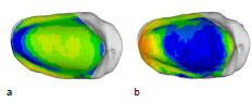 Abb. 47: Mittelwert (a) aller 15 Patellae und Standardabweichung (b). Ansicht der linken Patellagelenkflche.