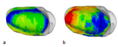 Abb. 49: Mittelwert (a) aller 5 mnnlichen Patellae und Standardabweichung (b). Ansicht der linken Patellagelenkflche.