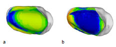 Abb. 50: Mittelwert (a) aller 10 weiblichen Patellae und Standardabweichung (b). Ansicht der linken Patellagelenkflche.