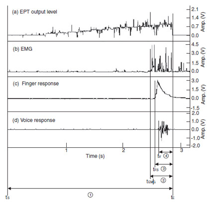 Figure 1 Records of output level, EMG, finger and voice responses during EPT (tS: start time, tE: end time, tEMG, tFS, tV: EMG, finger and voice response start time, 1 : total EPT stimulus time, 2  4 : measured excessive stimulus time according to EMG, finger and voice response, respectively).