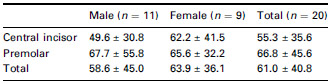 Table 2 Time delay (mean  SD, ms) between EPT output termination and onset of EMG