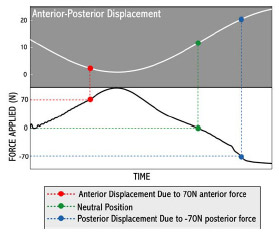 Figure 4-3: Cubic spline interpolations were fit to anterior-posterior displacement and force curves. Anterior and posterior laxity measures were determined by finding the AP displacement that corresponded with 70 N AP force. Neutral point was similarly found from the displacement at 0 N force.