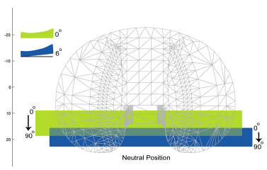 Figure 4-8: Schematic demonstrating neutral position differences between 0 and 6 posterior tibial slope. A 6 tibial slope reduced the overall travel of the neutral position as compared to the 0 slope condition, and it also placed the neutral point near the posterior edge of insert at 90.