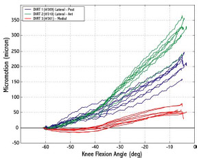 Figure 6-5: Differential variable reluctance transducer recordings were repeatable between trials. All recordings start from 0 because the reading at peak quadriceps force was used as a baseline.