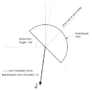 Figure 1. Joint reaction force diagram.