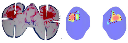 Fig. 1. Contacts determined using Fuji film and the contact determination algorithm