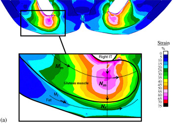 fig 4a