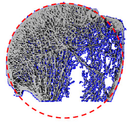 Figure 5 Humeral head radius of curvature.