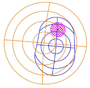 Figure 19 The overlap area of the humeral head and glenoid component is shown in pink. The black point is the centroid of the pink contact area.