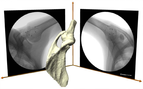 Figure 32 Virtual DFIS created in computer space from the actual geometry of the fluoroscopes shown with 3D model of the scapula and humerus.