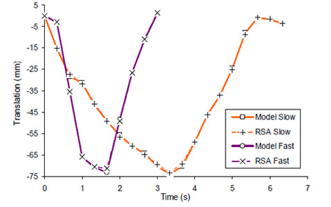 Figure 34 Scapula protraction/retraction translation as a function of cycle time in approximately the coronal plane.