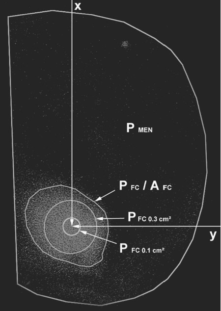 measurement parameters