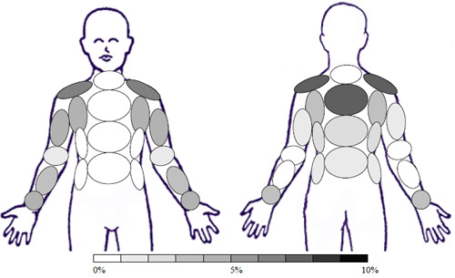 Sample: GSTL � Garment Starched Light 1 time - Activity: Toe Touches and Arm Raises