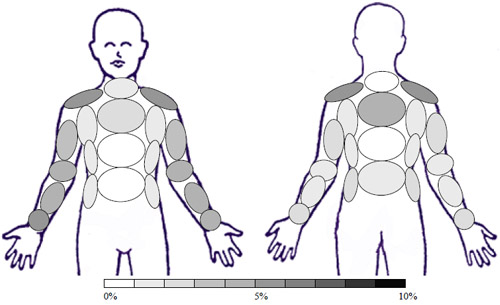 Sample: GC � No Treatment - Activity: Donning