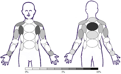 Sample: GC � No Treatment - Activity: Toe Touches and Arm Raises