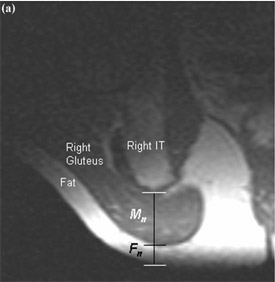 fig 2a