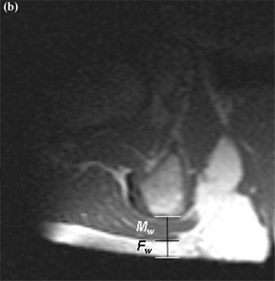 fig 2b