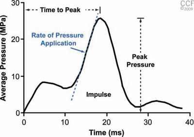 Profile showing impact