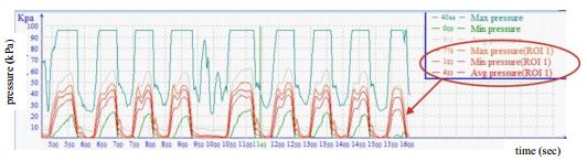 Dynamic pressure curve during a walking cycle 