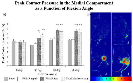 Biomechanics - Fig.4