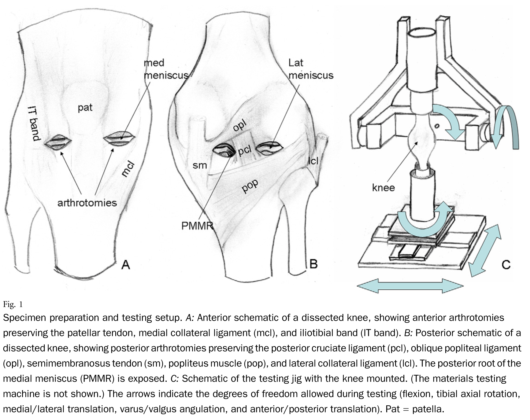 Anterior-schematic-of-a-dissected-knee