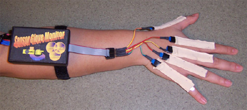 Figure 1 - Prototype of the sensor glove monitor. - The monitor is shown with five sensors placed on the MCP joints. Signal conditioning is contained in the box. The next prototype will include a wireless link for data download to an external computer, enabling the removal of the cable extending out of the back of the box.