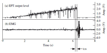 Figure 2 Control of electric pulp tester’s output using EMG response (tCB: time delay between EMG response start time and EPT circuit break).